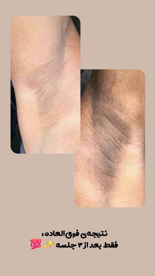 خدمات پاکسازی و درمان پوست یلدا اکبری در شیراز